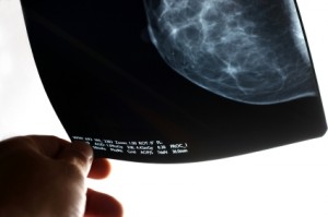 Mammografibilde