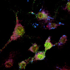 Makrofagar har ete bakteriar (blå), og bakteriane vert registrert av signalprotein (raudt og grønt) som set i gong immunforsvaret. Desse proteina kan vere viktige i kreftbehandling.