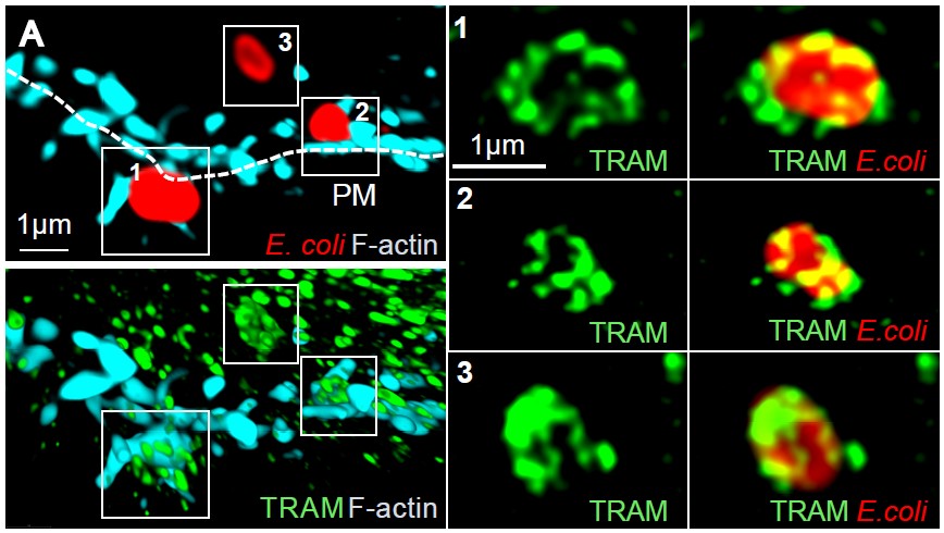 Mikroskopbilde av TRAM proteiner røde og grønne