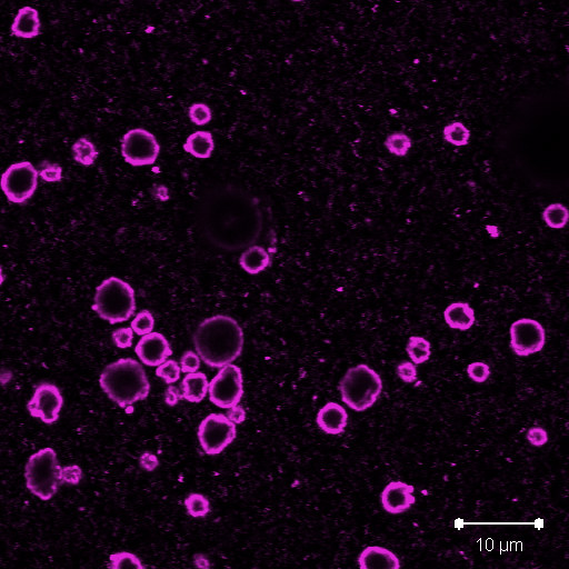 Gassbobler laget av nanopartikler sett gjennom konfokalmikroskopet. (Foto: Yrr Mørch/SINTEF)