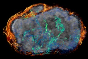 Ovarian tumor grown on the leg of the mouse in grey (MRI) overlaid with blood vessels from micro-CT images that are densely surrounding the tumor (orange) and feeding into it to form a chaotic network (green/blue).  Photo: Jana Cebulla