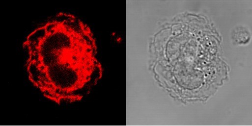 Toll-Like Receptor 2 (TLR2) in human monocytes. A human monocyte (right) and a confocal microscopy image of a human monocyte stained with a TLR2 antibody (red) (left) showing where TLR2 is expressed in the cell.