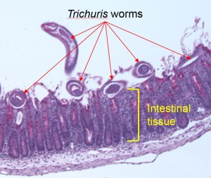 Trichuris worms
