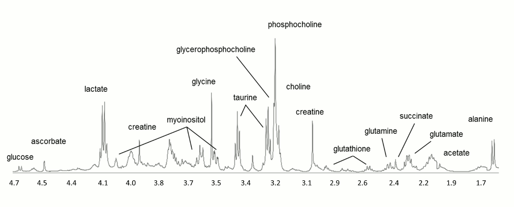 The figure shows some of the metabolites we can observe by performing MR spectroscopy on breast cancer tissue.