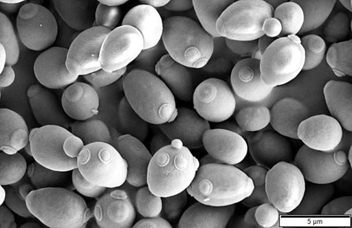 "Brødgjæra Saccharomyces cerevisiae sett i mikroskop". (Bilde fra Mogana Das Murtey and Patchamuthu Ramasamy ([1]) [CC BY-SA 3.0 (http://creativecommons.org/licenses/by-sa/3.0)], via Wikimedia )Commons