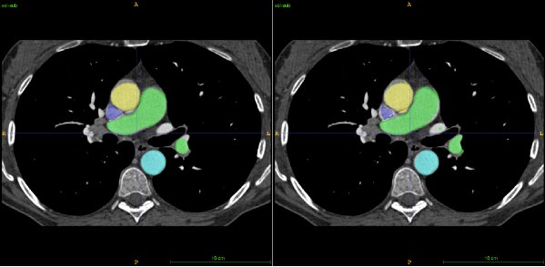 CT images with organ segmentation.