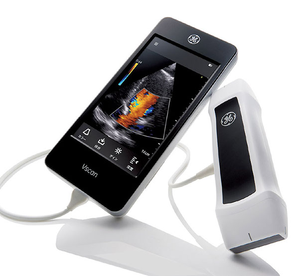 vscan handheld ultrasound device