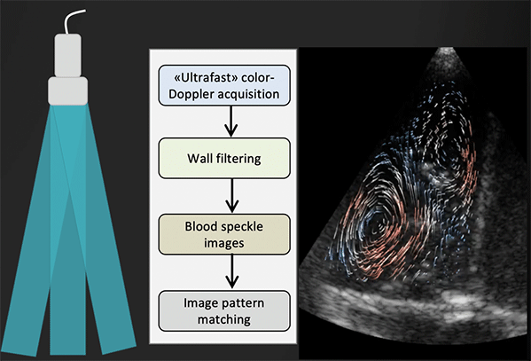 Graphic showing ultrasound of pediatric heart chambers.